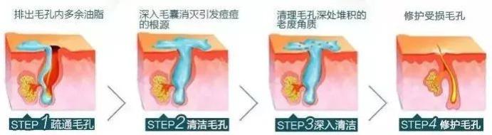 “刷酸”护肤，美丽不打烊